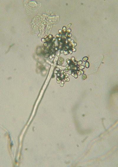 Mildews Spots and Moulds Ascomycete Fungi Images UK